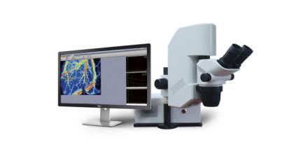 laser speckle imaging system