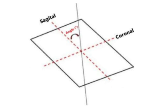 sagital coronal